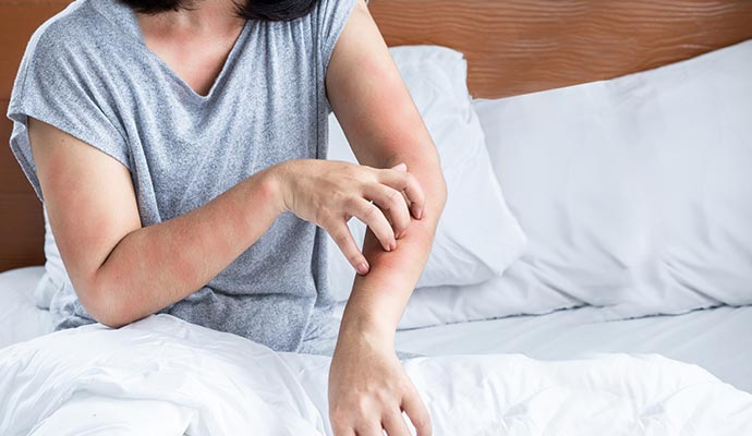 Itchy rash and irritated skin on a person’s arm from a dust mite allergy